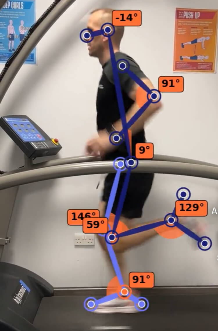 Running Gait Analysis Dronfield Running Gait Analysis Dronfield